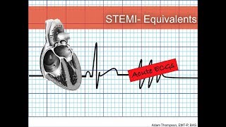 STEMI Equivalents [upl. by Eecak]