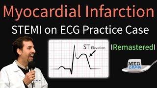 Thrombolysis in Myocardial Infarction TIMI Score  MEDZCOOL [upl. by Donetta]