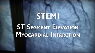 STEMI  ACS Treatment  ECG Interpretation Case 15 Part 2 [upl. by Lleddaw]