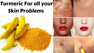 Top 3 Ways To Use Turmeric For Skin Pigmentation Skin Whitening amp Skin Tags  Home Remedies [upl. by Tila]