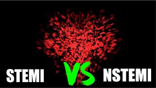 NSTEMI vs STEMIEKGs [upl. by Zsamot833]