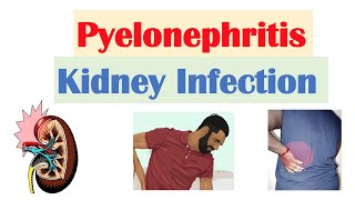 Urine infections Cure and Treatment by Dr SKPal at Apollo Spectra Hospitals [upl. by Nailluj]