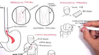 Intravenous Sedation for Endoscopy Colonoscopy [upl. by Barnes]