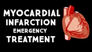 Myocardial Infarction Heart Attack for Nursing amp NCLEX [upl. by Ykcaj]