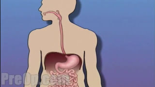 Esophagogastroduodenoscopy [upl. by Esdnil351]