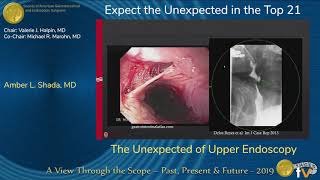 GORD GERD Gastro Oesophageal Reflux Disease  Overview pathophysiology treatment [upl. by Erik]