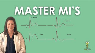 Acute Coronary Syndrome DETAILED Overview MI STEMI NSTEMI [upl. by Aicatan]