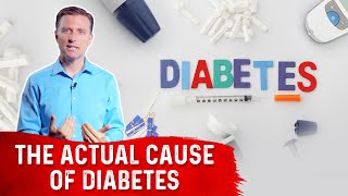 The Underlying Cause Of Diabetes – DrBerg [upl. by Mattland]