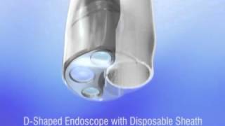 EndoSheath® Cystoscopy [upl. by Ennylyak]